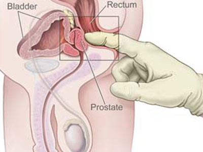 Prostate massage 